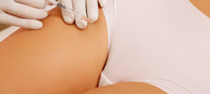 Leia mais sobre o artigo Preenchimento Íntimo