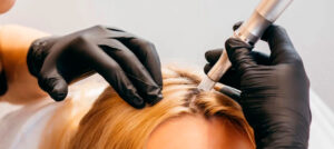 Leia mais sobre o artigo MMP® capilar